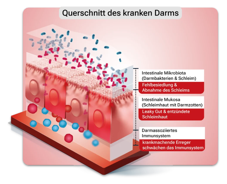 Querschnitt des kranken Darms